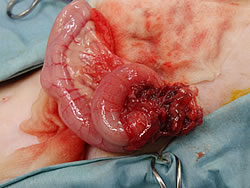 腸管どうしが癒着し塊になっている部分を切除