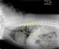 胸部のレントゲン写真